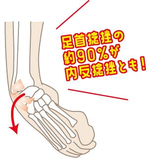 足首捻挫の約90％が内反捻挫とも！