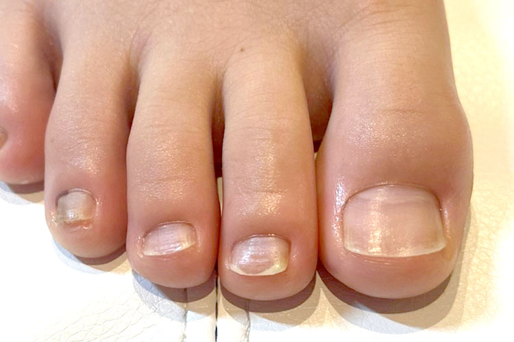 深足の爪はスクエアオフ