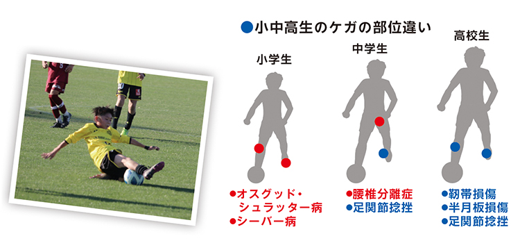 小中高生のケガの部位違い